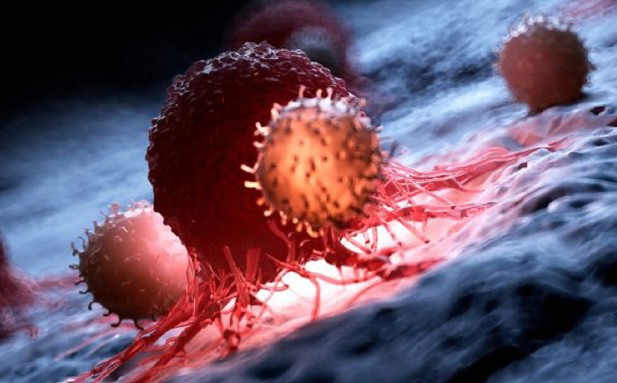 باحثون في جامعة تكساس الأميركية يطوّرون جهازًا مبتكرًا للكشف عن مرض السّرطان