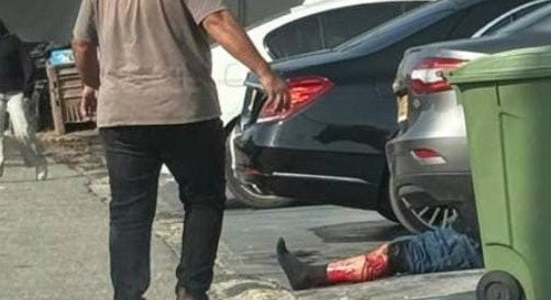 دبورية: إصابة متوسطة لرجل جرّاء تعرضه لإطلاق نار