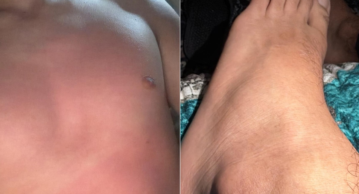 ضربوني بالمفكات على أرجلي المشلولة.. صرخة فتى مقعد (17 عاماً) من كفر قرع يتهم الشرطة بالتنكيل به