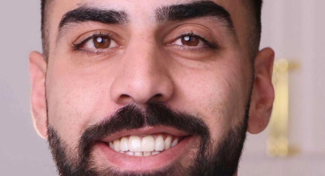 كفر سميع: وفاة الشاب روحي مرزوق متأثراً بجراحه إثر حادث طرق مروع