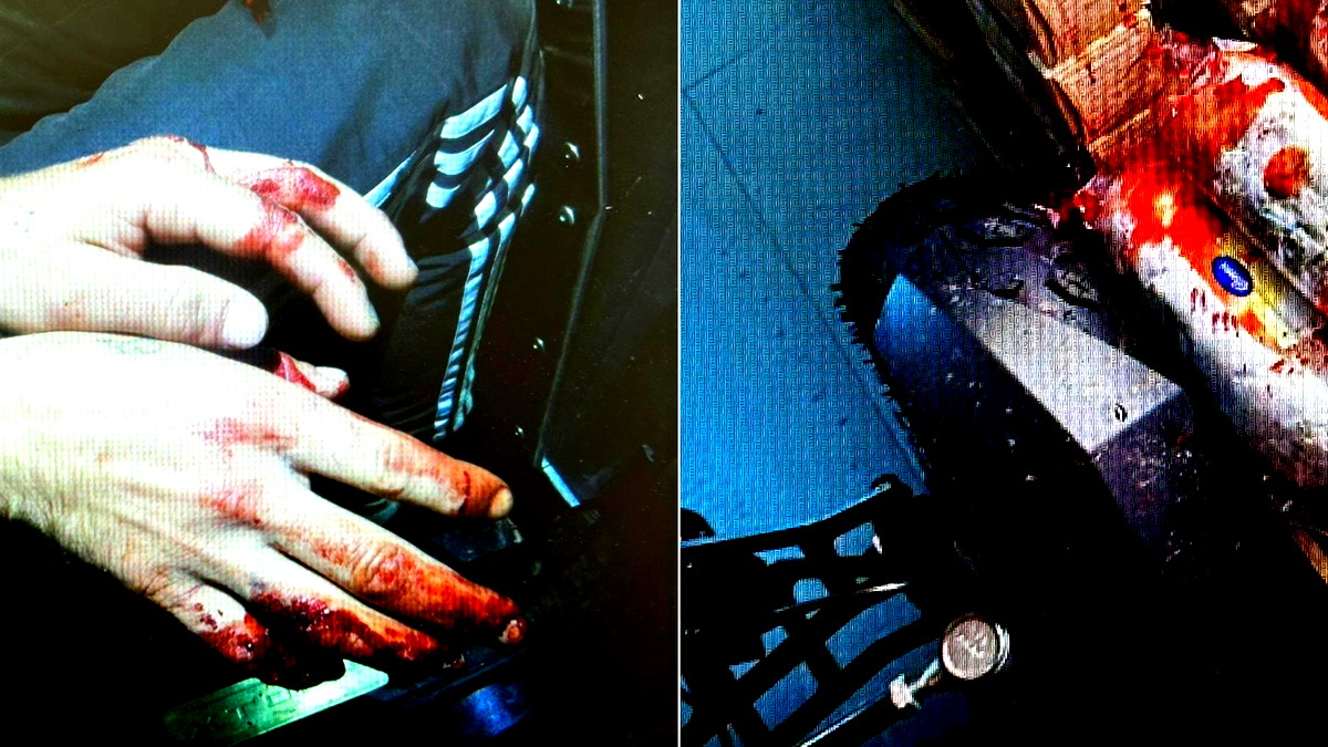 حاول سرقة دراجة كهربائية ثمينة فأصيب بيده بشظايا| تصريح مدّع عام ضد مشتبه (24 عامًا) من القدس