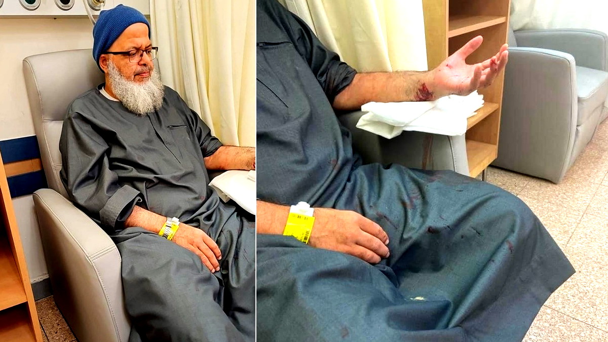 إصابة الحاج عارف أبو مديغم من رهط اثر مهاجمته من قبل كلاب ضالة وهو في طريقه لصلاة الفجر 