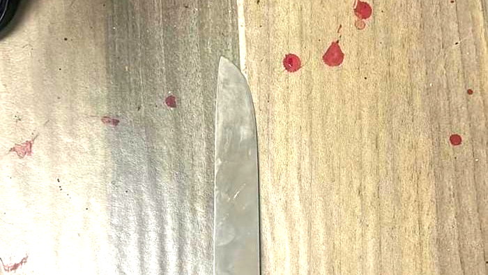 مصابان بعملية طعن في ميشور أدوميم شرق القدس وتحييد المشتبه