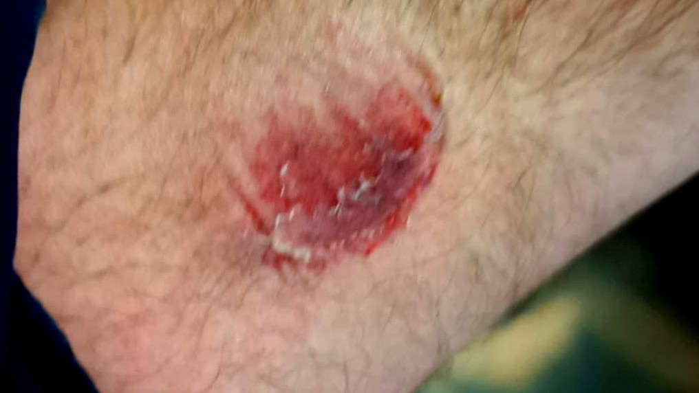 القدس: اعتقال مشتبه بالاعتداء على سائق حافلة ورجال شرطة 