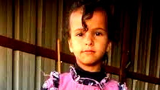 تحسن طفيف يطرأ على حالة الطفلة أمينة الحسوني من النقب التي أصيبت بشظايا صاروخية في "الهجوم الايراني"