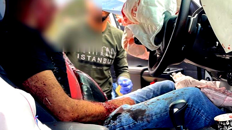 اصابة محمد ابو ربيع (53 عامًا) بجراح خطيرة اثر تعرضه لاطلاق نار في الرينة