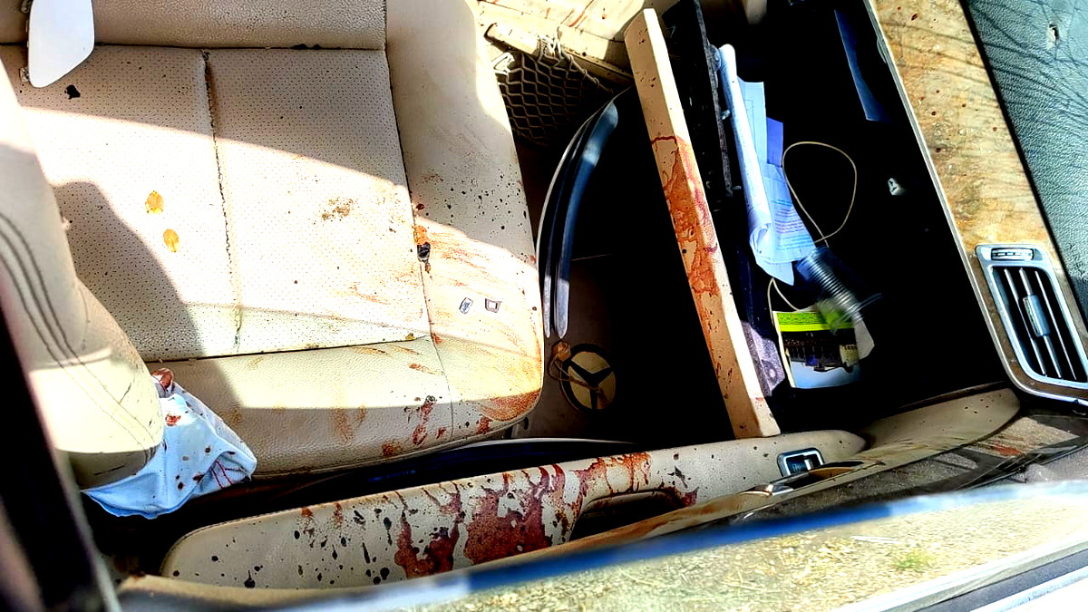 تقديم لائحة اتهام ضد شاب فقد يده نتيجة حادث عمل في البقيعة- بعد انفجار قنبلة انبوبية في يده