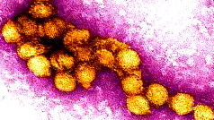 وفاة 11 إسرائيليا وإصابة 153 آخرين بحمى غرب النيل