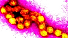 وزارة الصحة تعلن حصيلة جديدة للوفيات والإصابات بحمى غرب النيل