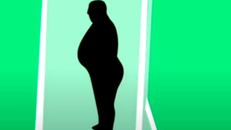 أسباب غير شائعة للسمنة.. عوامل خفية تؤثر على زيادة الوزن