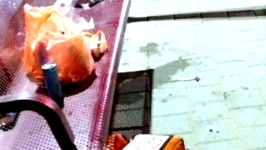 أوفاكيم: إصابة رجل (50 عامًا) بجروح خطيرة إثر تعرضه لحادثة عنف