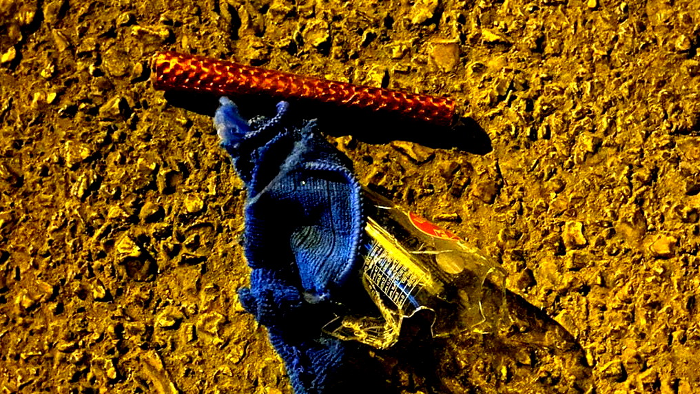 القدس: اصابة شاب بجراح خطيرة برصاص الشرطة في العيسوية بادعاء محاولة القاء زجاجة حارقة