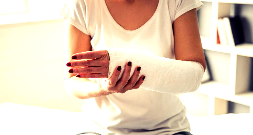 خمسة معتقدات خاطئة حول كسور العظام 