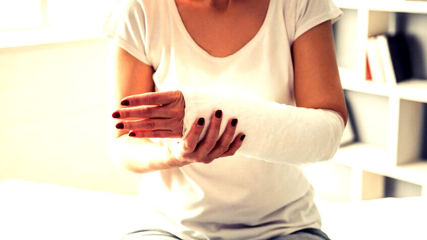 خمسة معتقدات خاطئة حول كسور العظام