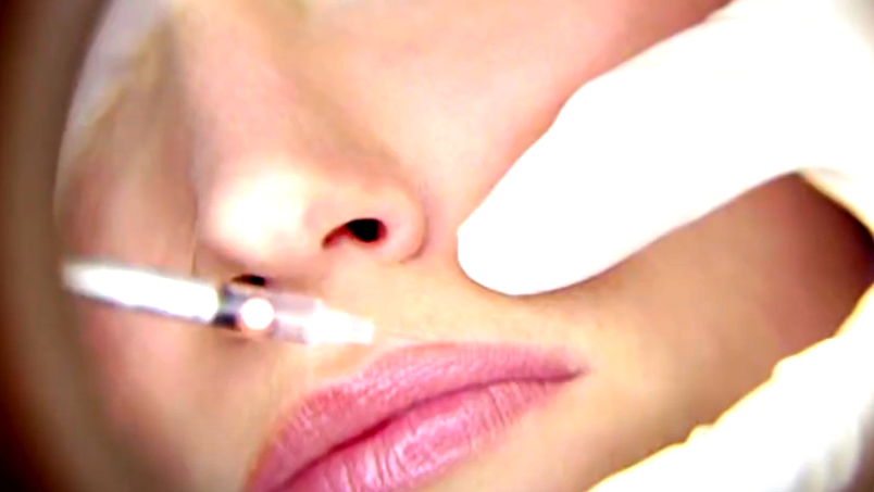 حقن البوتوكس يتسبّب بمخاطر كبيرة إذ لم يتمّ بالشكل الصحيح وتحت إشراف مختصين