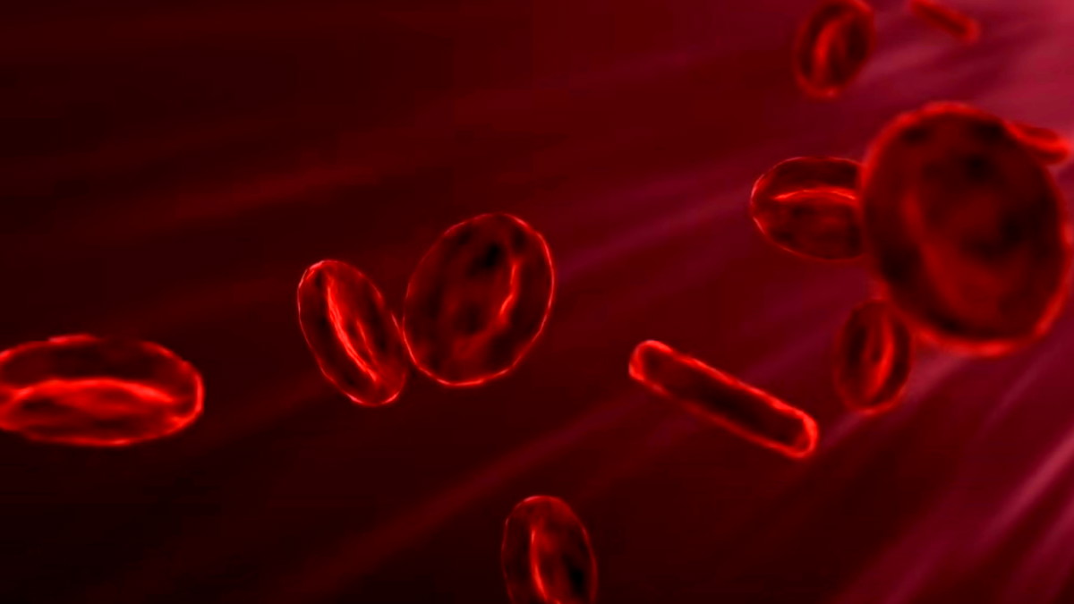 أطعمة تساعد على امتصاص الحديد: نصائح غذائية لمن يعانون من فقر الدم