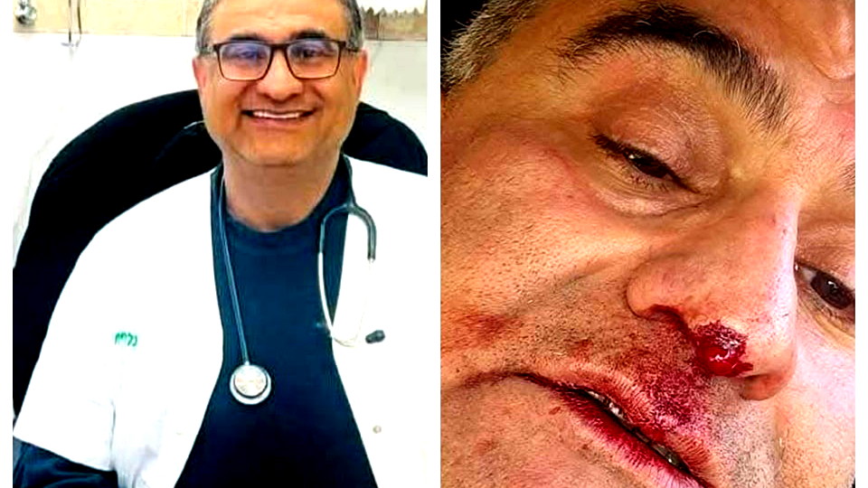 عنصرية بلا حدود  | اتهام شاب من منطقة الخضيرة بالاعتداء على الطبيب محمد مصالحة من كفرقرع لانه عربي