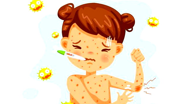 وزارة الصحة تُعلن عن اكتشاف اصابات جديدة بمرض الحصبة