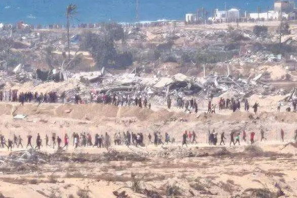 70 ألف طفل بغزة يواجهون مستويات حادة من سوء التغذية