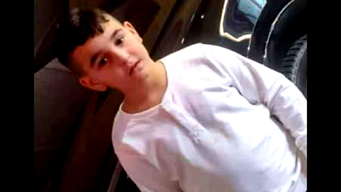 إصابة حرجة للطفل نور معاذ مرة (11 عامًا) من الناصرة إثر سقوطه عن حصان وعائلته تدعو الجميع الدعاء له