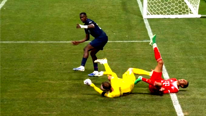 بايرن ميونخ.. موسيالا يعاني من كسر في الشظية وإصابة في الأربطة