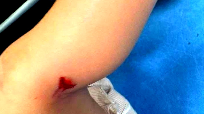 في أحضان عائلتها: إصابة رضيعة (9 أشهر) برصاصة طائشة في رهط