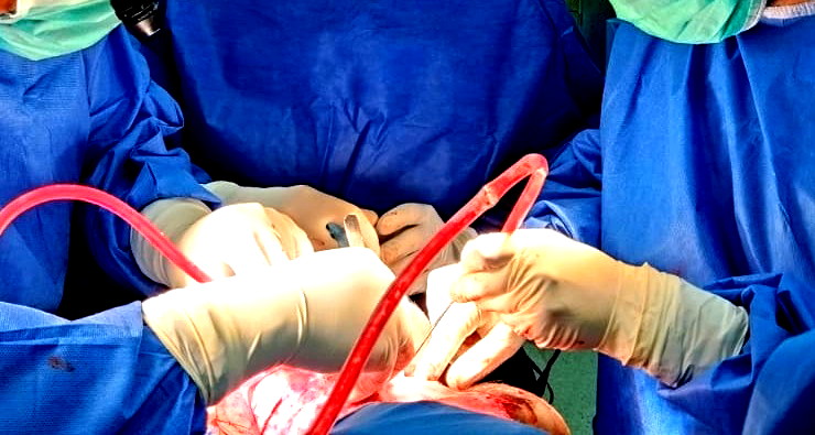 إنجاز طبي: أول ولادة في إسرائيل بعد استئصال الرحم، واحدة من ست حالات في العالم 