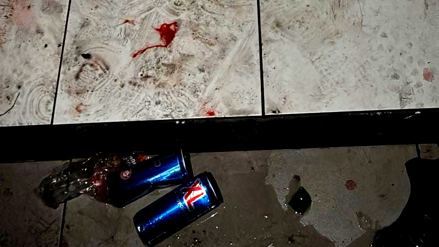 إصابة شاب (21 عامًا) بجروح متوسطة جرّاء تعرضه لحادثة عنف.. اعتقال 5 مشتبهين داخل شقة في القدس