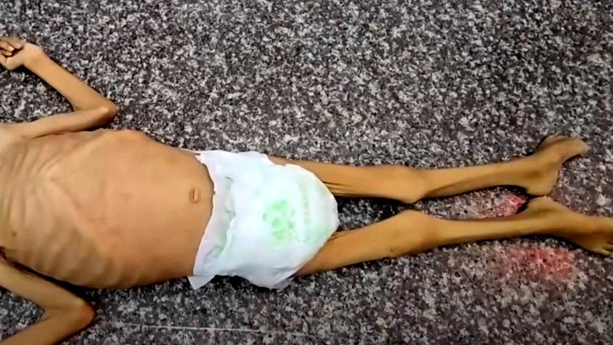 تقرير دولي: غزة على حافة المجاعة والأمم المتحدة تحذّر من "أسوأ سيناريو"