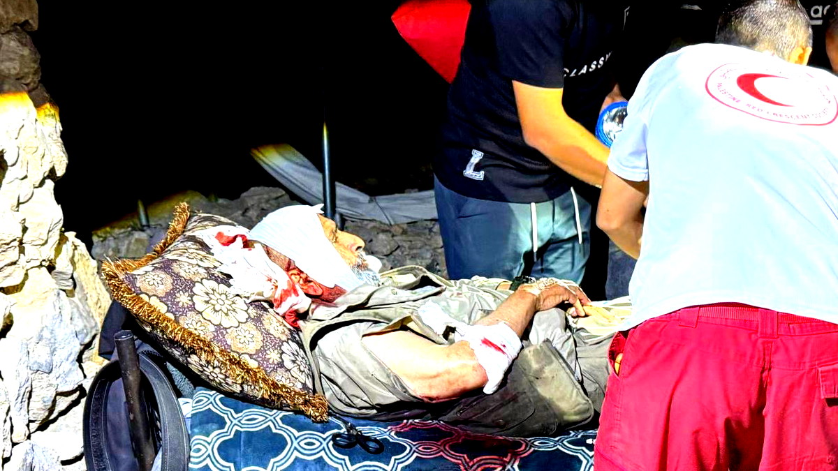 ثلاثة جرحى بينهم طفل في هجوم نفذه مستوطنون على قرية جنوب الخليل