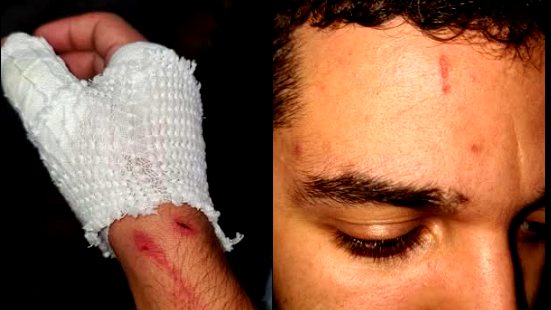 بلدية أم الفحم: بيان شجب واستنكار لحادث الاعتداء الاجرامي على الطالب الجامعي الفحماوي عوض محمد بربور