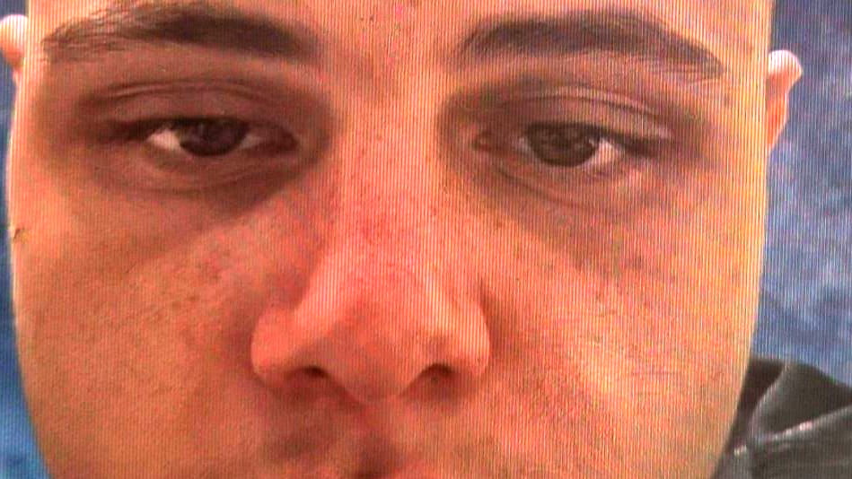 العثور على الشاب محمد خاسكية من الطيرة بعد اختفاء اثارة