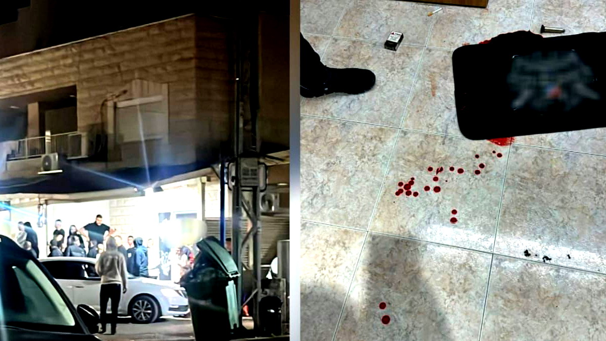 كفرمندا: إصابة شاب بجراح متوسطة إثر إطلاق نار