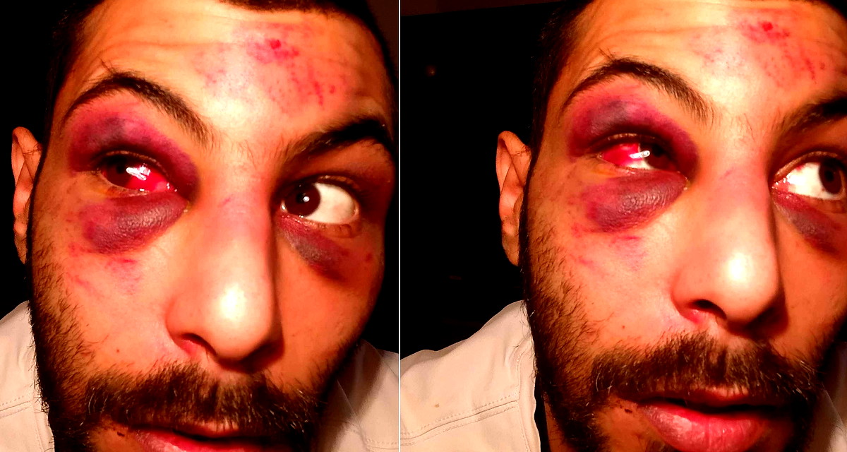 "أطفأوا الكاميرات وضربوني بالكراسي".. شهادة مروعة لشاب من الطيبة تعرض لتنكيل شرطي