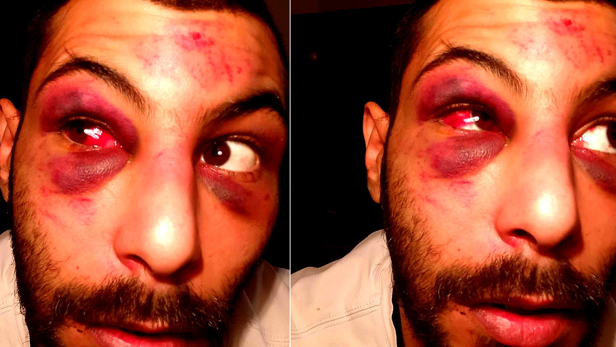 "أطفأوا الكاميرات وضربوني بالكراسي".. شهادة مروعة لشاب من الطيبة تعرض لتنكيل شرطي