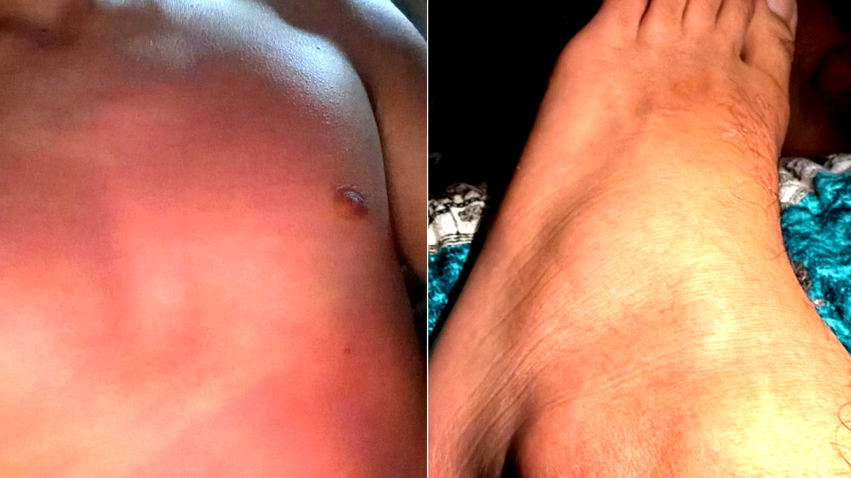 ضربوني بالمفكات على أرجلي المشلولة.. صرخة فتى مقعد (17 عاماً) من كفر قرع يتهم الشرطة بالتنكيل به