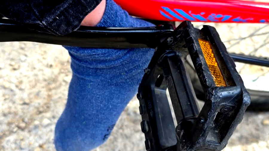 القدس: تخليص طفل 5 سنوات علقت قدمه بين قضبان دراجة هوائية