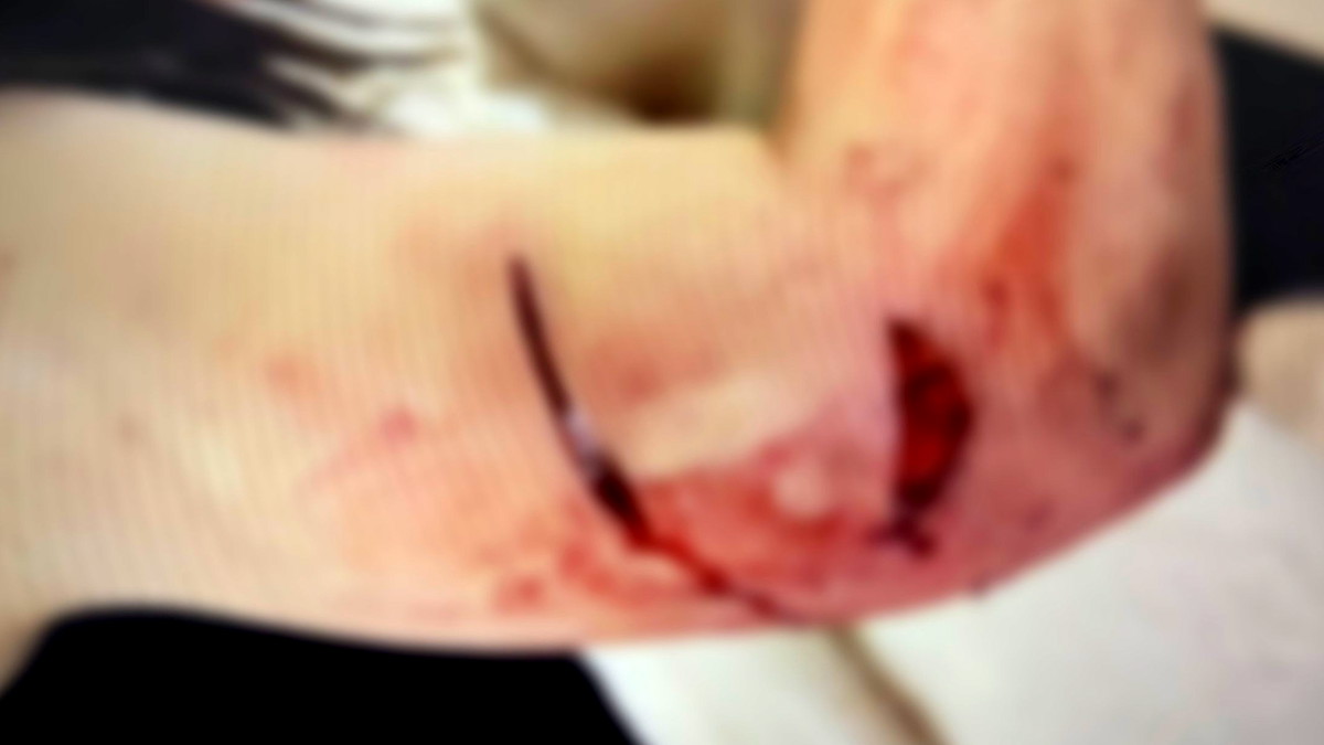 "سأدفنكِ وأنتِ على قيد الحياة": لائحة اتهام بمحاولة قتل ضد مقدسي طعن شريكته بدافع الغيرة