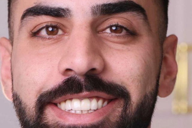كفر سميع: وفاة الشاب روحي مرزوق متأثراً بجراحه إثر حادث طرق مروع