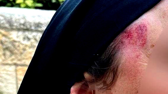 القدس: اعتقال شخص (36 عامًا) بشبهة الاعتداء على راهبة بدوافع عنصرية