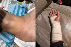 الشرطة ترد بعد حادثة الاعتداء على شبان من دير الأسد: أفرادنا تعرضوا للاعتداء والمحكمة دعمت روايتنا