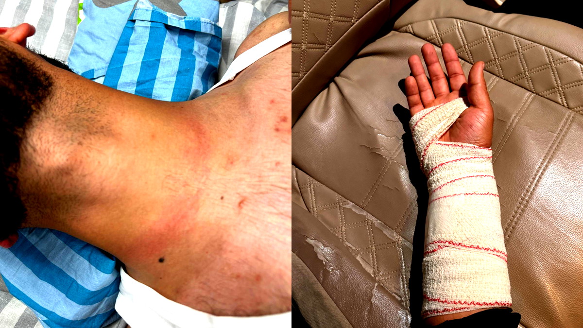 الشرطة ترد بعد حادثة الاعتداء على شبان من دير الأسد: أفرادنا تعرضوا للاعتداء والمحكمة دعمت روايتنا
