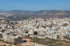 شابة من كفركنا تتبرع بكليتها لعمتها: "حلمي أن أراها سعيدة".